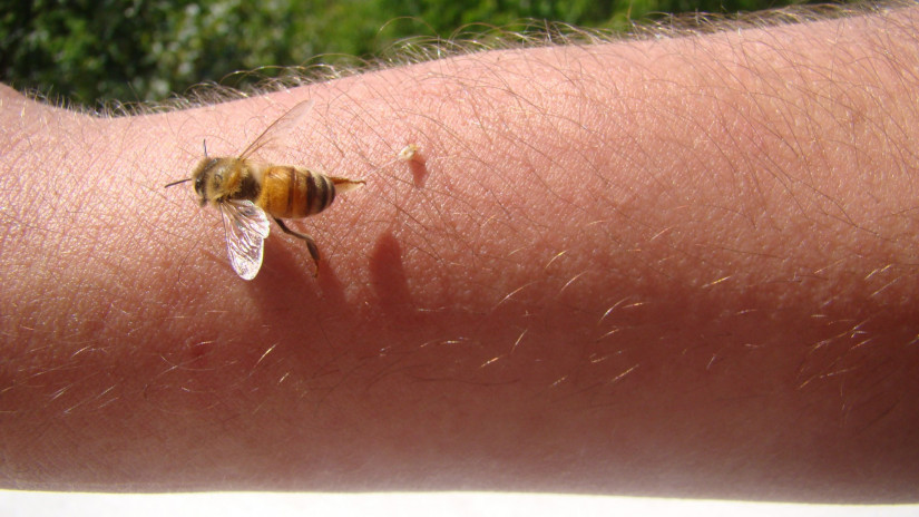 Rejtélyes csípések: méhcsípés