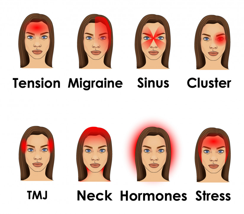 A fejfájás gyakori típusai
