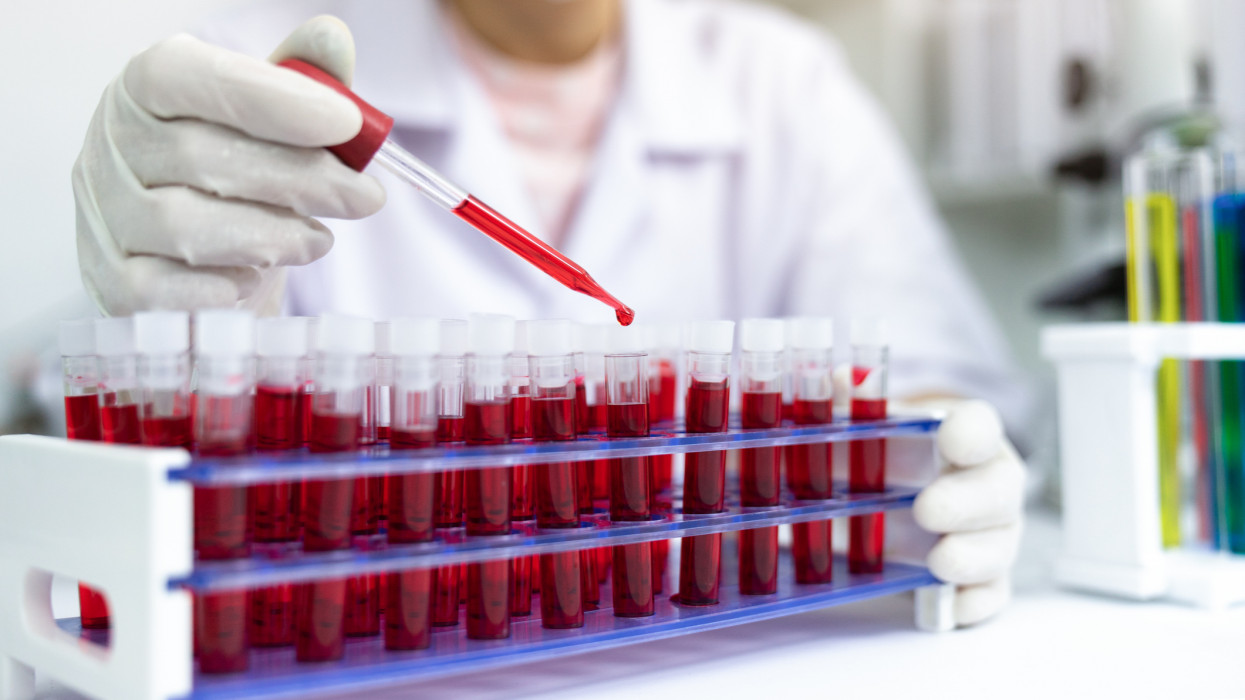 Health care, Blood test,Blood research