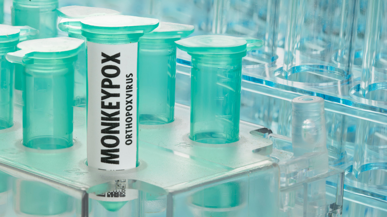 Monkeypox virus in laboratory vials and test tubes