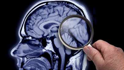 Meglepő dolog derült ki az emberi agyról: a kutatók is megdöbbentek, mire bukkantak