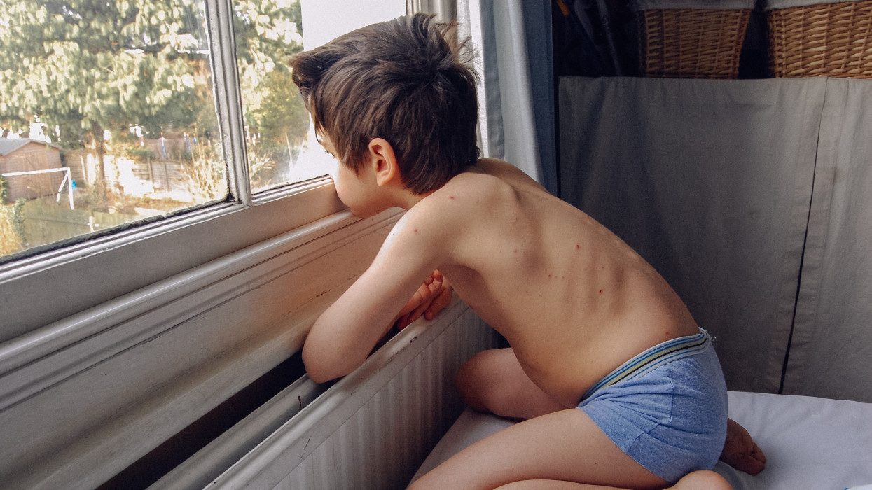 Rég nem látott gyerekbetegség lángolhat fel újra Magyarországon: már most rengeteg a fertőzött