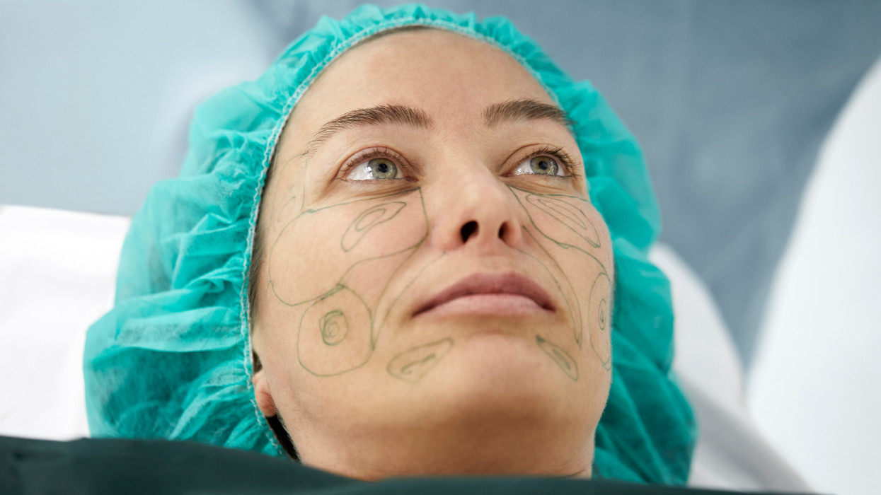 Close-up of young woman with correction lines on face. High angle view of female patient is lying on operating table. She is in emergency room.