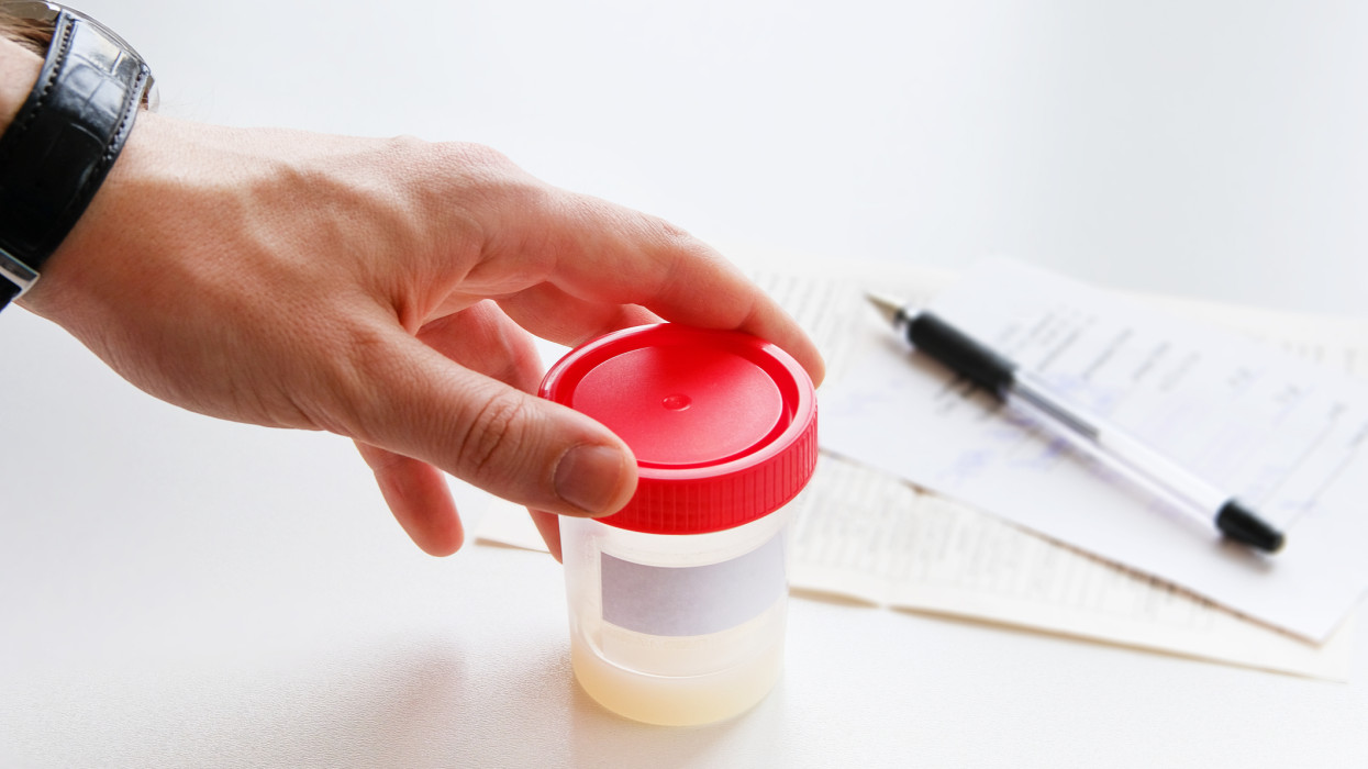 A man puts a medical container with semen analysis labeled, next to the completed form, on a white background. Donor sperm for artificial insemination, infertility treatment, planning of children.