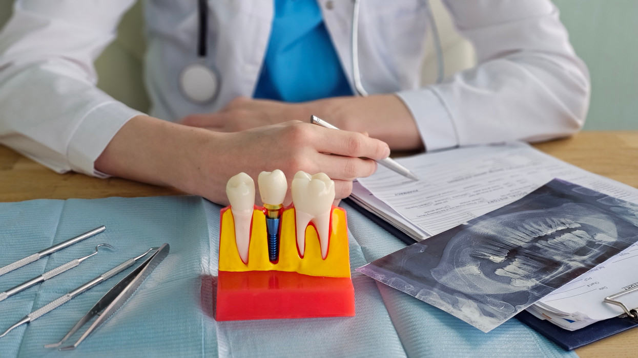 Magyarok százezrei búcsúzhatnak az ingyenes ellátástól? Ez fájni fog: rengeteg praxis áll üresen, marad a magánút